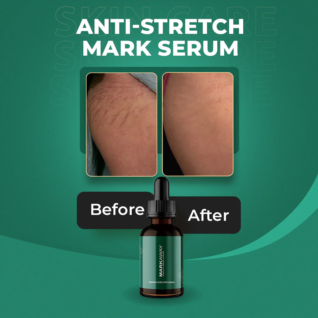 Mark Away Stretch Mark Remover Serum
